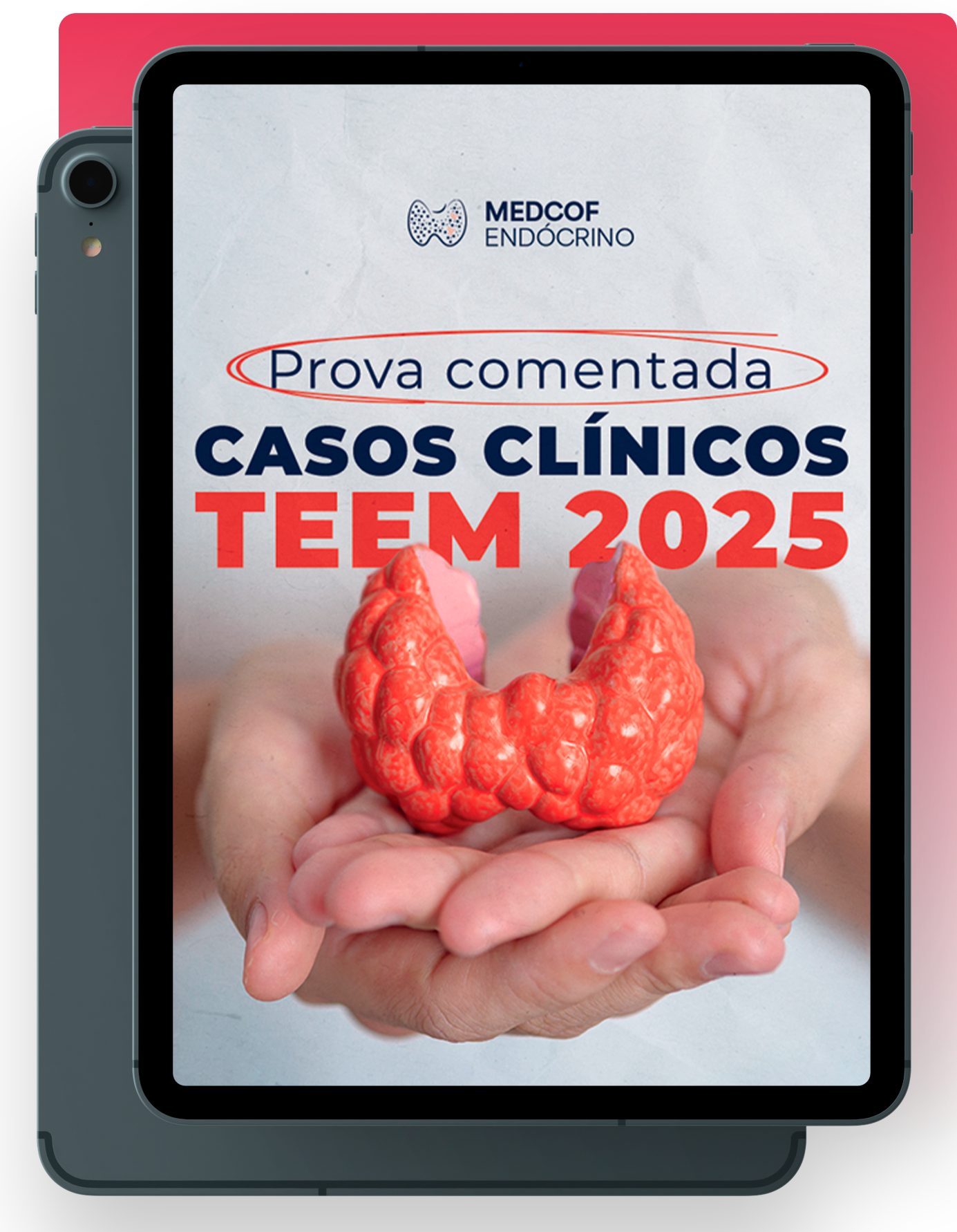 Mockup da Prova Comentada do TEEM 2025